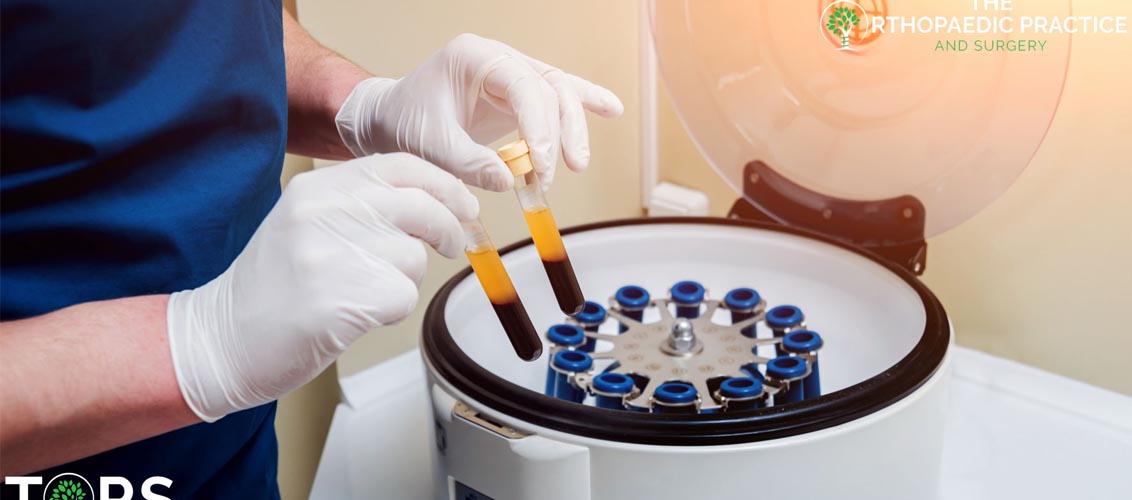 Platelet Rich Plasma (PRP) Injection therapy